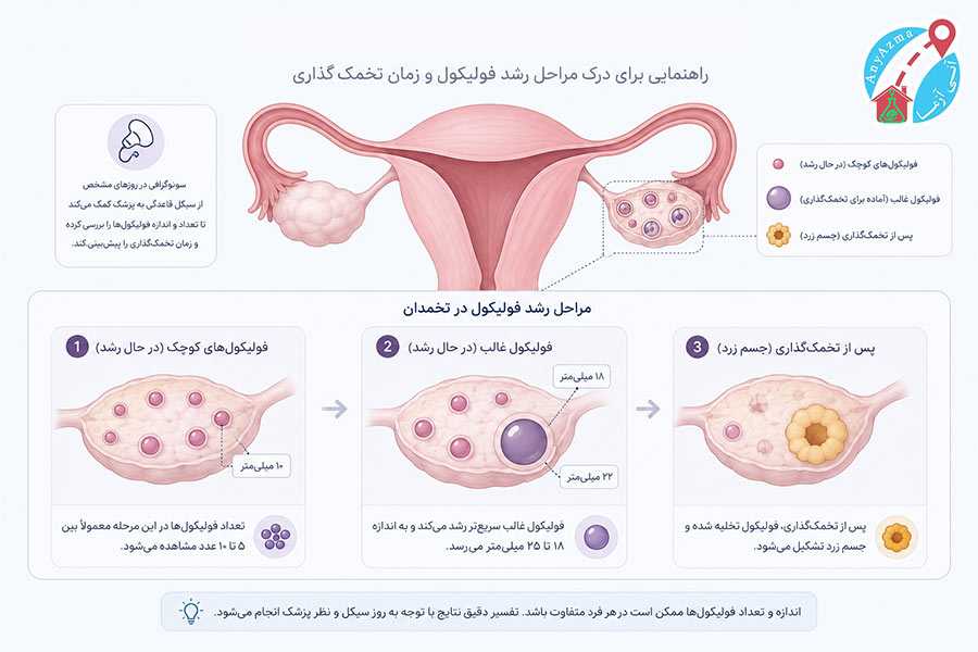 تفسیر سونوگرافی فولیکول تخمدان