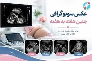 عکس سونوگرافی جنین هفته به هفته