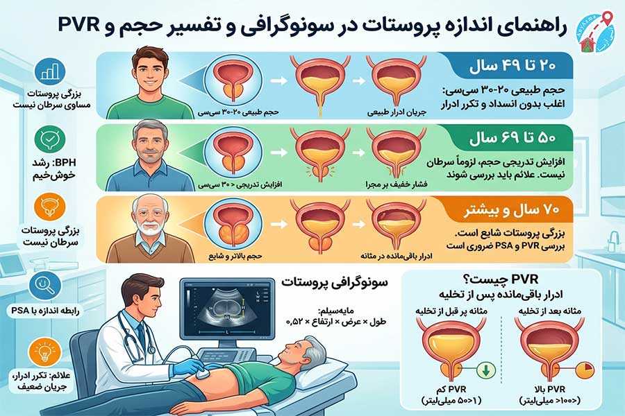اینفوگرافی اندازه طبیعی پروستات در سونوگرافی