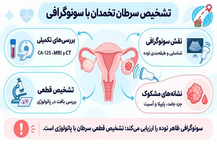 اینفوگرافی تشخیص سرطان تخمدان با سونوگرافی