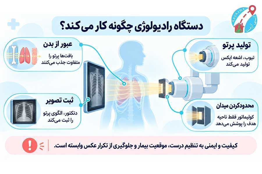 اینفوگرافی دستگاه رادیولوژی