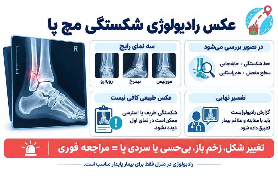 اینفوگرافی عکس رادیولوژی شکستگی مچ پا 