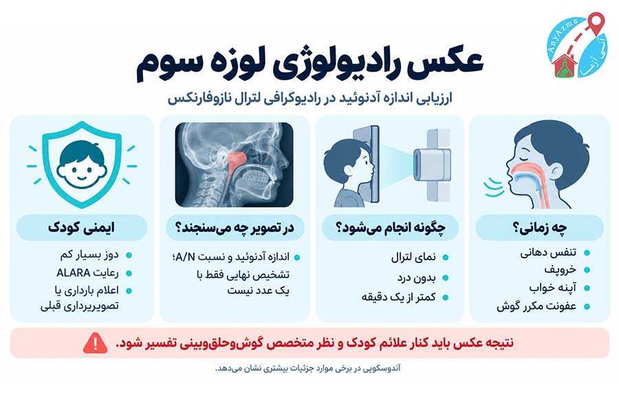 اینفوگرافی عکس رادیولوژی لوزه سوم